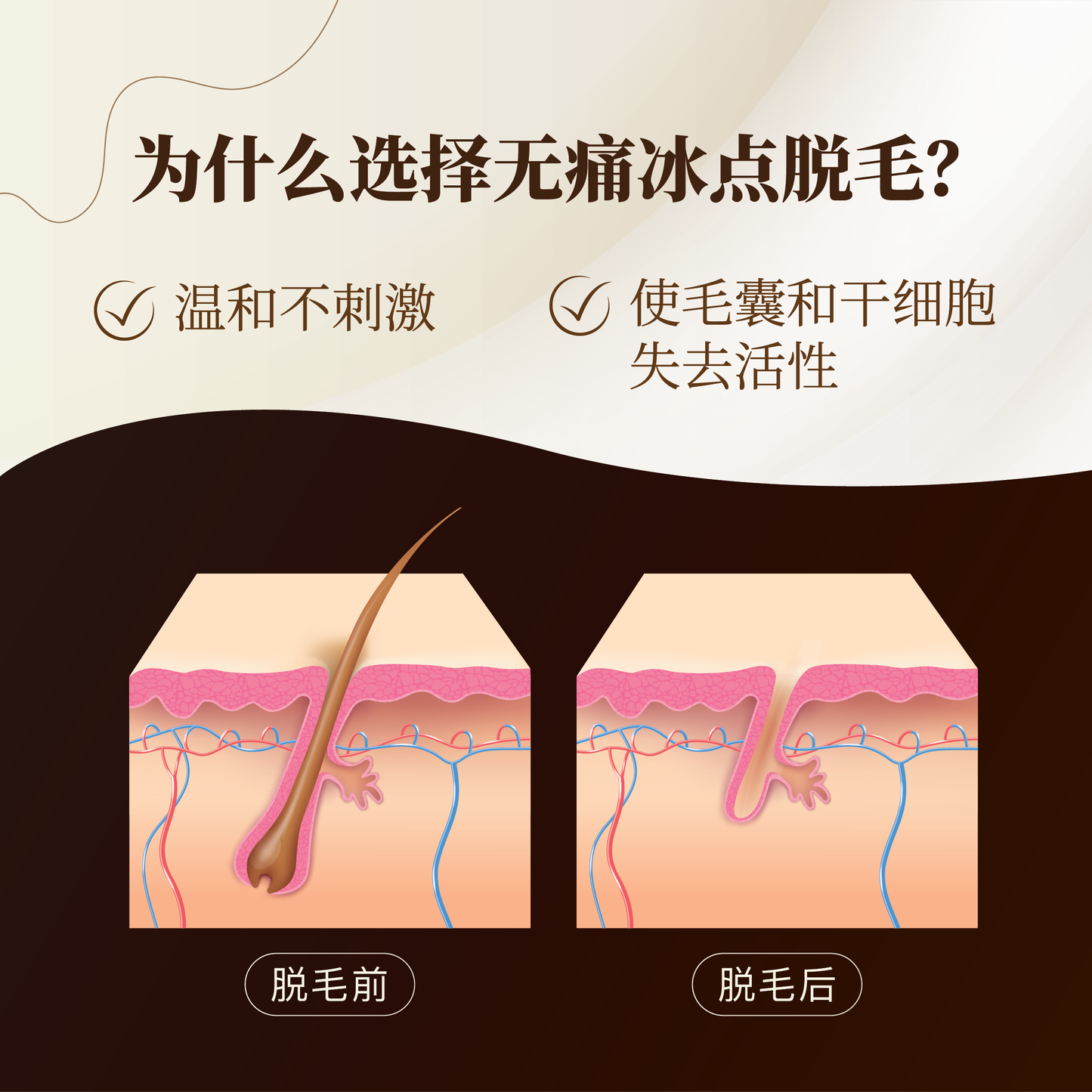 无痛冰点脱毛 -初次体验价 (Armpit) - Painless Ice-Point Hair Removal - First-Time Trial Price